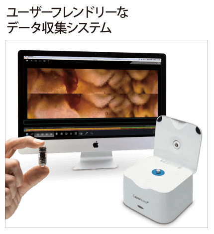 ユーザーフレンドリーなデータ収集システム