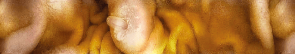 乳頭部：JPEG